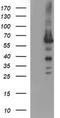 Tyrosine Hydroxylase antibody, CF506548, Origene, Western Blot image 