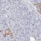 Twinkle protein, mitochondrial antibody, PA5-51715, Invitrogen Antibodies, Immunohistochemistry paraffin image 