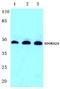 Adenosine A2a Receptor antibody, A02268, Boster Biological Technology, Western Blot image 