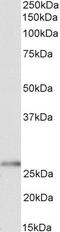 ITK antibody, 43-388, ProSci, Western Blot image 