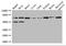 Collagen Type VIII Alpha 1 Chain antibody, A62310-100, Epigentek, Western Blot image 