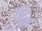S100 Calcium Binding Protein A8 antibody, 11138-MM03, Sino Biological, Immunohistochemistry frozen image 