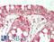 DExD/H-Box Helicase 58 antibody, LS-B14053, Lifespan Biosciences, Immunohistochemistry paraffin image 