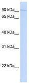 Synapse Defective Rho GTPase Homolog 1 antibody, TA329499, Origene, Western Blot image 