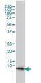 Heat Shock Protein Family E (Hsp10) Member 1 antibody, H00003336-M01, Novus Biologicals, Western Blot image 