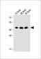 Ornithine Carbamoyltransferase antibody, A00721-2, Boster Biological Technology, Western Blot image 