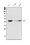 Adenosine Kinase antibody, M02193, Boster Biological Technology, Western Blot image 