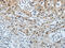 p21 antibody, CSB-PA934176, Cusabio, Immunohistochemistry paraffin image 