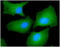 Fascin Actin-Bundling Protein 1 antibody, GTX57621, GeneTex, Immunocytochemistry image 