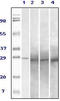 RAB25, Member RAS Oncogene Family antibody, STJ98347, St John
