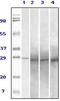 Ras-related protein Rab-25 antibody, STJ98347, St John