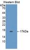 Hexosaminidase Subunit Beta antibody, LS-C372564, Lifespan Biosciences, Western Blot image 