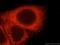 Ecotropic Viral Integration Site 2A antibody, 17415-1-AP, Proteintech Group, Immunofluorescence image 