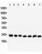 Ras-related protein Rab-9A antibody, LS-C313374, Lifespan Biosciences, Western Blot image 