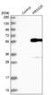 Serine Protease 35 antibody, NBP1-86756, Novus Biologicals, Western Blot image 