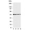 Cystathionine Gamma-Lyase antibody, R30633, NSJ Bioreagents, Western Blot image 