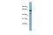 Methyltransferase Like 14 antibody, PA5-43606, Invitrogen Antibodies, Western Blot image 