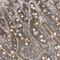 Protein Phosphatase, Mg2+/Mn2+ Dependent 1B antibody, HPA016745, Atlas Antibodies, Immunohistochemistry paraffin image 