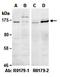 SWI/SNF Related, Matrix Associated, Actin Dependent Regulator Of Chromatin Subfamily C Member 1 antibody, orb66929, Biorbyt, Western Blot image 