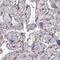 Collagen Type VIII Alpha 2 Chain antibody, NBP2-13857, Novus Biologicals, Immunohistochemistry frozen image 