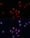 SMAD Family Member 5 antibody, 18-406, ProSci, Immunofluorescence image 