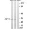 ADP/ATP translocase 3 antibody, A09457, Boster Biological Technology, Western Blot image 
