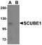 Signal Peptide, CUB Domain And EGF Like Domain Containing 1 antibody, A07935, Boster Biological Technology, Western Blot image 