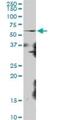 Ribosomal RNA Processing 8 antibody, H00023378-B01P, Novus Biologicals, Western Blot image 