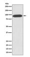 Valosin Containing Protein antibody, M00610, Boster Biological Technology, Western Blot image 