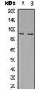 Microtubule Affinity Regulating Kinase 2 antibody, abx121438, Abbexa, Western Blot image 