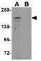 ATPase Secretory Pathway Ca2+ Transporting 1 antibody, GTX31834, GeneTex, Western Blot image 