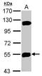 Katanin Catalytic Subunit A1 Like 1 antibody, PA5-31641, Invitrogen Antibodies, Western Blot image 