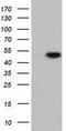 Ribonuclease/Angiogenin Inhibitor 1 antibody, GTX83697, GeneTex, Western Blot image 