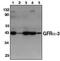 GDNF Family Receptor Alpha 3 antibody, MBS395885, MyBioSource, Western Blot image 
