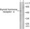 Thyroid Hormone Receptor Alpha antibody, abx013209, Abbexa, Western Blot image 