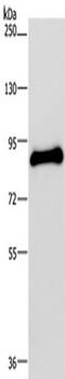 Protein O-Mannosyltransferase 1 antibody, TA351547, Origene, Western Blot image 