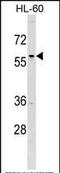 Transcription Factor AP-2 Delta antibody, PA5-35193, Invitrogen Antibodies, Western Blot image 