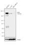 ERBB2 antibody, MA5-14057, Invitrogen Antibodies, Western Blot image 