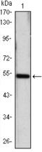 Sonic Hedgehog Signaling Molecule antibody, MBS830860, MyBioSource, Western Blot image 