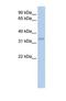 Carbonic Anhydrase 4 antibody, NBP1-69373, Novus Biologicals, Western Blot image 