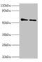 3-Oxoacid CoA-Transferase 1 antibody, orb352878, Biorbyt, Western Blot image 