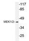 MEK1/2 antibody, AP20702PU-N, Origene, Western Blot image 