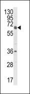 Cytochrome P450 Family 2 Subfamily C Member 18 antibody, LS-C167221, Lifespan Biosciences, Western Blot image 