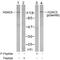 Histone Deacetylase 5 antibody, NB100-81953, Novus Biologicals, Western Blot image 