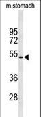 Potassium Voltage-Gated Channel Subfamily J Member 11 antibody, LS-C165427, Lifespan Biosciences, Western Blot image 