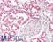 Mucin 20, Cell Surface Associated antibody, LS-B15861, Lifespan Biosciences, Immunohistochemistry paraffin image 