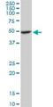 Adipocyte Plasma Membrane Associated Protein antibody, H00057136-B01P, Novus Biologicals, Western Blot image 