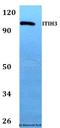 Inter-Alpha-Trypsin Inhibitor Heavy Chain 3 antibody, A07339, Boster Biological Technology, Western Blot image 