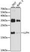 LLP Homolog, Long-Term Synaptic Facilitation Factor antibody, A15534, ABclonal Technology, Western Blot image 