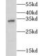 Calponin 2 antibody, FNab01800, FineTest, Western Blot image 